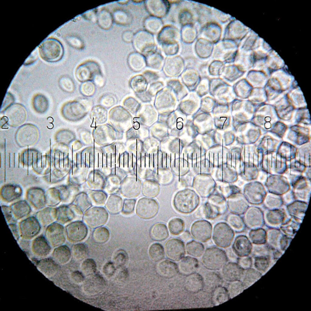 Baking yeast "Saccharomyces Cerevisiae" under the microscope; it is also used for beer brewing